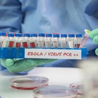 Ebola Photo