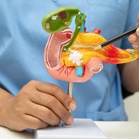 Pancreatic cancer